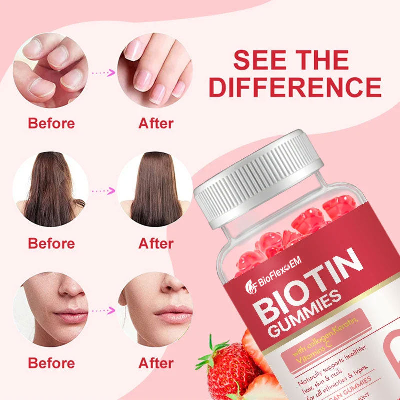Vegan Biotin Gummies – Hair Growth, Strong Nails & Skin Whitening